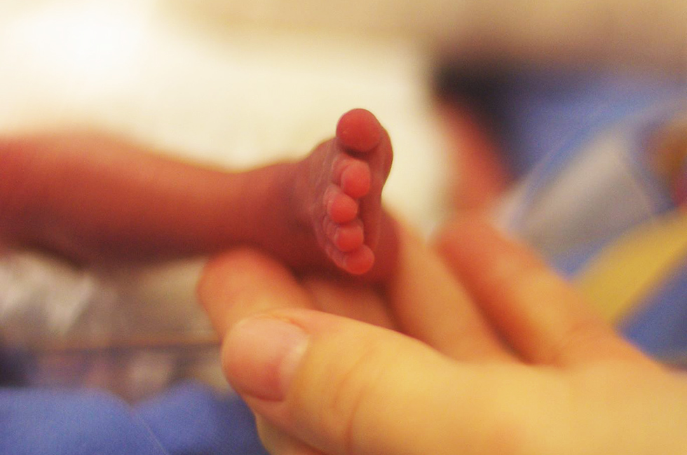 Prematur fot